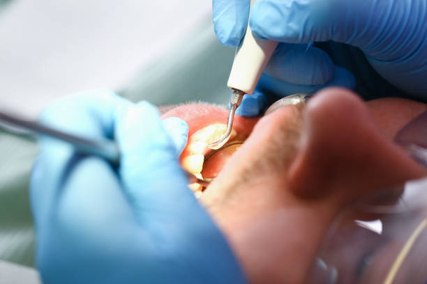 Best Knocked-Out Tooth Emergency  in Crenshaw, MS