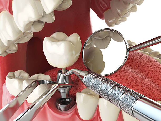 Best Root Canal Emergency Dentist  in Crenshaw, MS